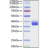 SDS-PAGE - Recombinant SARS-CoV Spike RBD Protein (C-terminal His Tag) (A331815) - Antibodies.com