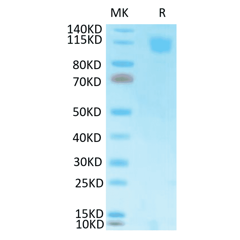 Tris-Bis PAGE - Recombinant SARS-CoV Spike RBD Protein (C-terminal His and Avi Tag) (A331817) - Antibodies.com