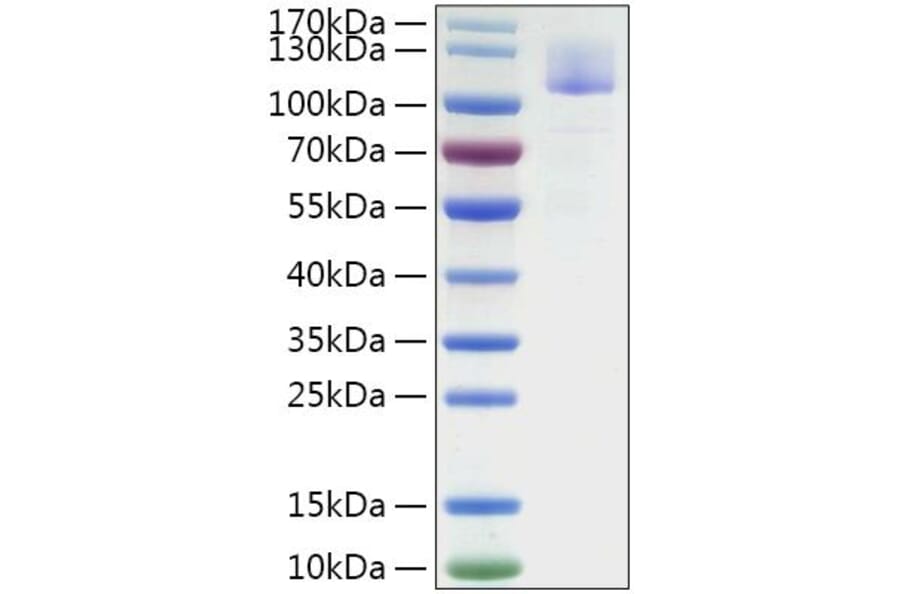 SDS-PAGE - Recombinant SARS-CoV Spike S1 Protein (C-terminal His Tag) (A331819) - Antibodies.com