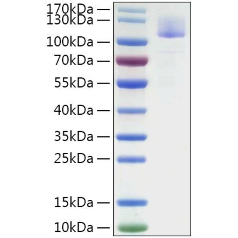 SDS-PAGE - Recombinant SARS-CoV Spike S1 Protein (C-terminal His Tag) (A331819) - Antibodies.com