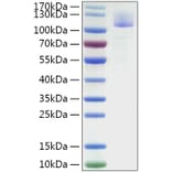 SDS-PAGE - Recombinant SARS-CoV Spike S1 Protein (C-terminal His Tag) (A331819) - Antibodies.com