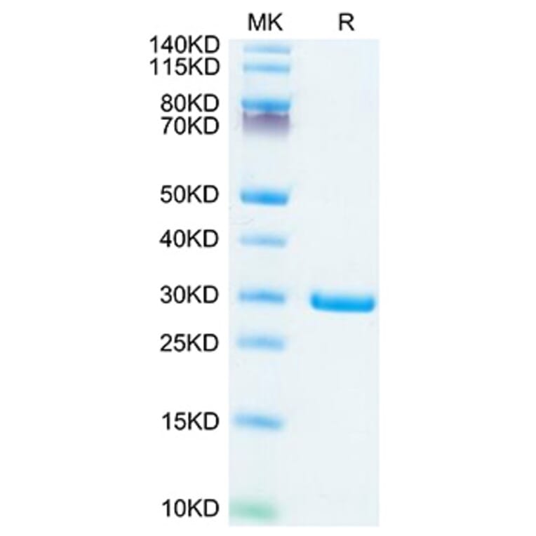 Tris-Bis PAGE - Recombinant SARS-CoV-2 NSP7 + NSP8 Protein (C-terminal His Tag) (A331820) - Antibodies.com