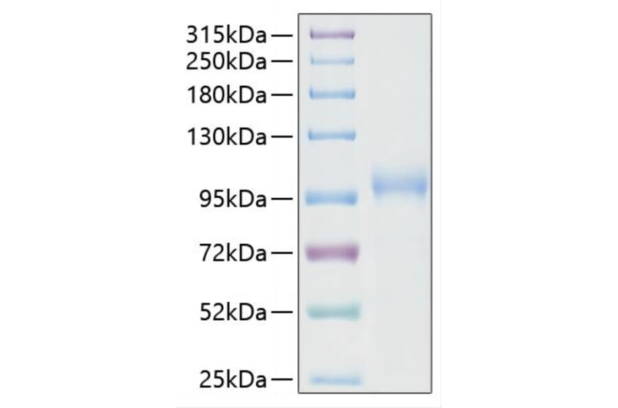 SDS-PAGE - Recombinant SARS-CoV-2 RNA-dependent RNA polymerase Protein (C-terminal His Tag) (A331821) - Antibodies.com