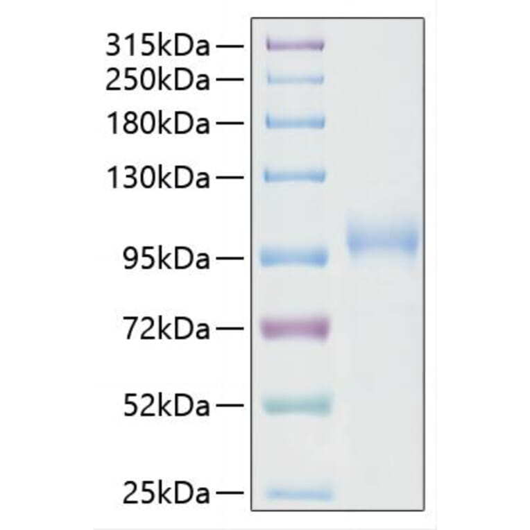 SDS-PAGE - Recombinant SARS-CoV-2 RNA-dependent RNA polymerase Protein (C-terminal His Tag) (A331821) - Antibodies.com