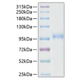 SDS-PAGE - Recombinant SARS-CoV-2 RNA-dependent RNA polymerase Protein (C-terminal His Tag) (A331821) - Antibodies.com
