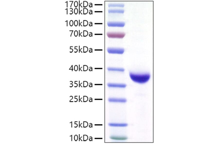 SDS-PAGE - Recombinant SARS-CoV-2 Spike RBD Protein (C-terminal His and Avi Tag) (A331822) - Antibodies.com