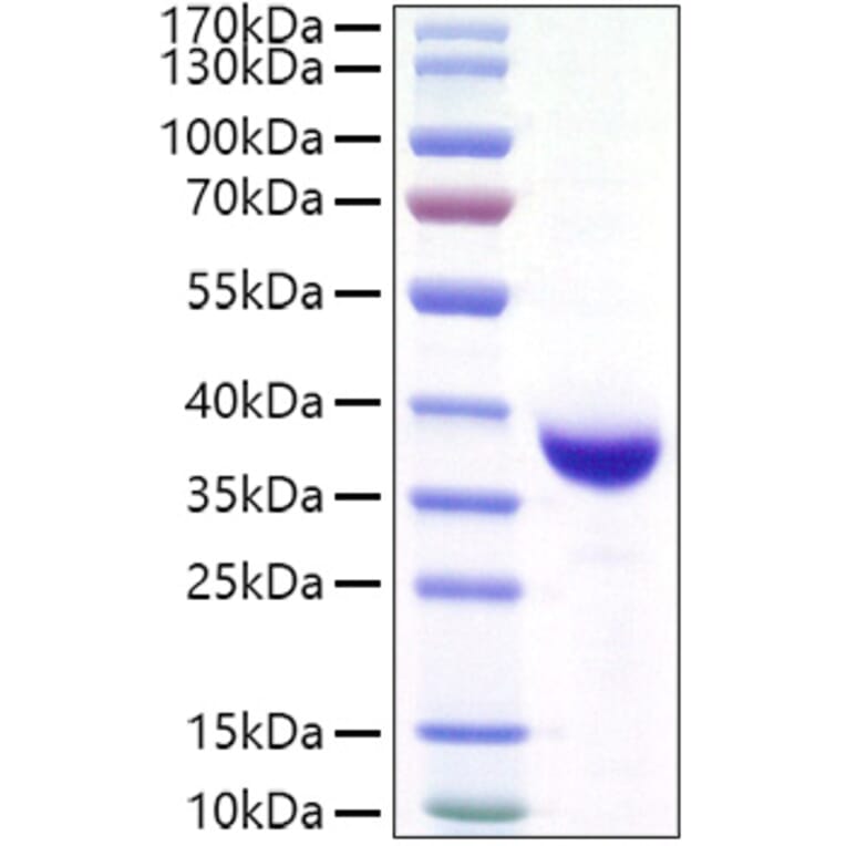 SDS-PAGE - Recombinant SARS-CoV-2 Spike RBD Protein (C-terminal His and Avi Tag) (A331822) - Antibodies.com