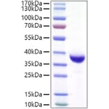 SDS-PAGE - Recombinant SARS-CoV-2 Spike RBD Protein (C-terminal His and Avi Tag) (A331822) - Antibodies.com