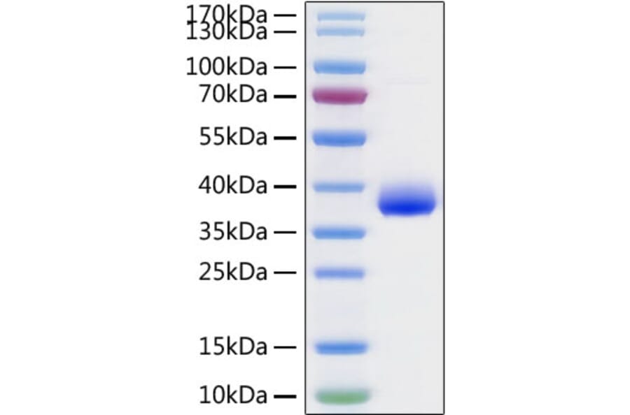 SDS-PAGE - Recombinant SARS-CoV-2 Spike RBD Protein (C-terminal His and Avi Tag) (A331823) - Antibodies.com