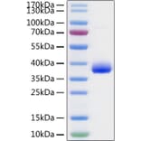 SDS-PAGE - Recombinant SARS-CoV-2 Spike RBD Protein (C-terminal His and Avi Tag) (A331823) - Antibodies.com