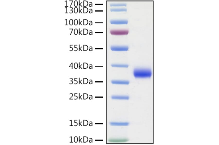 SDS-PAGE - Recombinant SARS-CoV-2 Spike RBD Protein (C-terminal His Tag) (A331824) - Antibodies.com