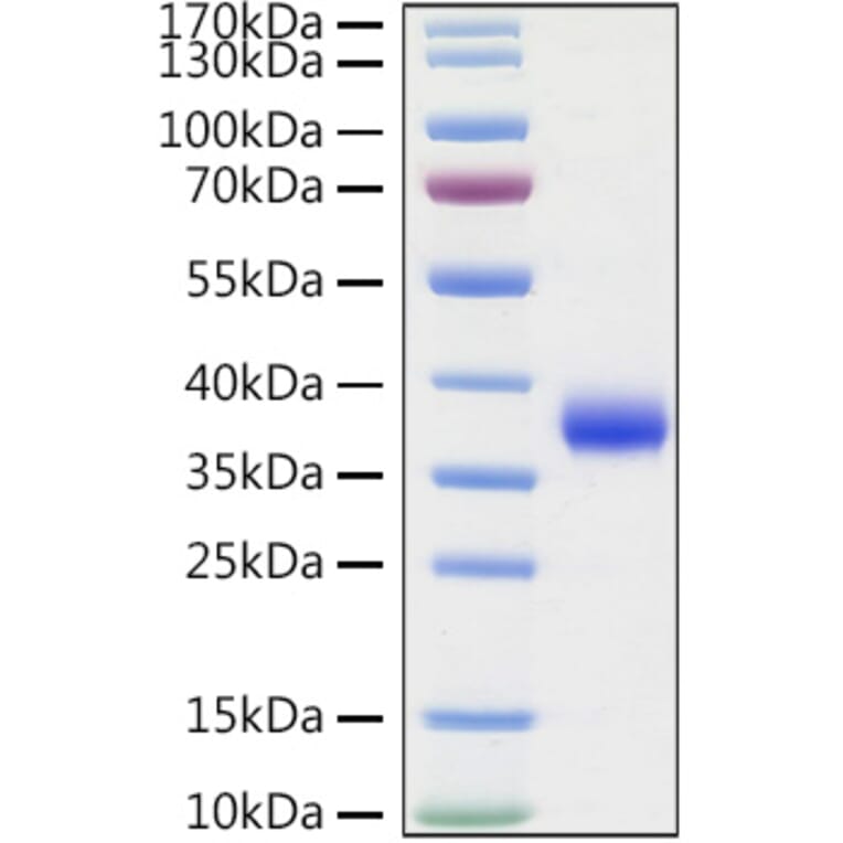 SDS-PAGE - Recombinant SARS-CoV-2 Spike RBD Protein (C-terminal His Tag) (A331824) - Antibodies.com