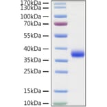 SDS-PAGE - Recombinant SARS-CoV-2 Spike RBD Protein (C-terminal His Tag) (A331824) - Antibodies.com