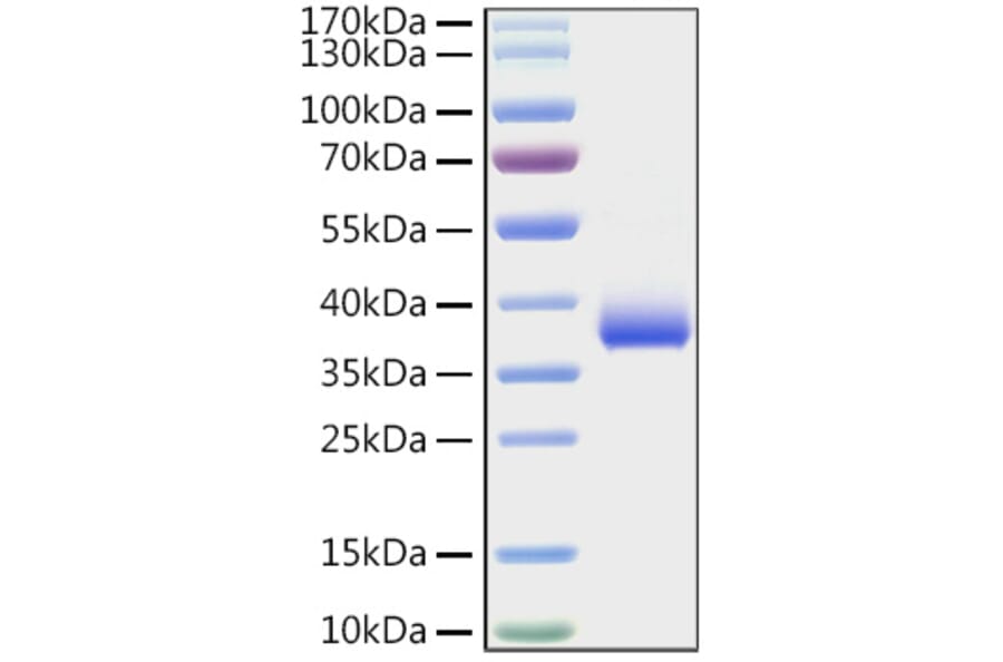 SDS-PAGE - Recombinant SARS-CoV-2 Spike RBD Protein (C-terminal His Tag) (A331825) - Antibodies.com