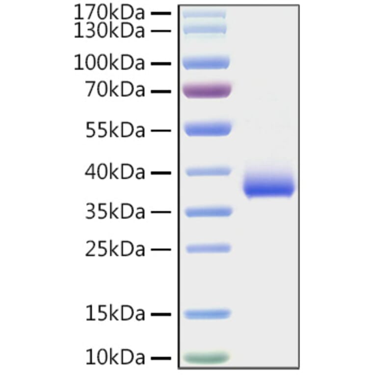 SDS-PAGE - Recombinant SARS-CoV-2 Spike RBD Protein (C-terminal His Tag) (A331825) - Antibodies.com