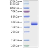 SDS-PAGE - Recombinant SARS-CoV-2 Spike RBD Protein (C-terminal His Tag) (A331825) - Antibodies.com