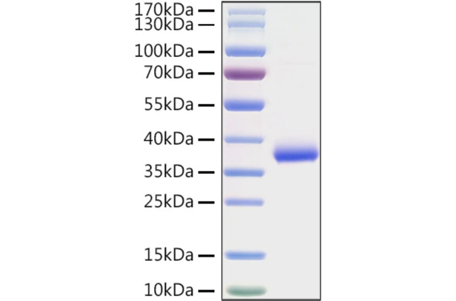 SDS-PAGE - Recombinant SARS-CoV-2 Spike RBD Protein (C-terminal His Tag) (A331826) - Antibodies.com