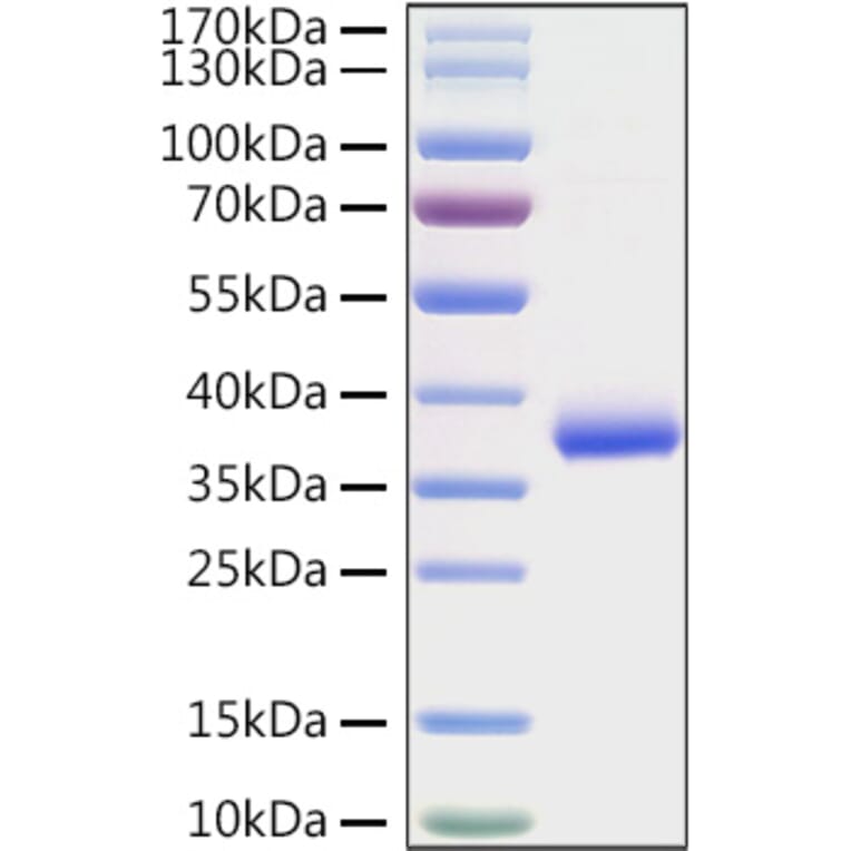 SDS-PAGE - Recombinant SARS-CoV-2 Spike RBD Protein (C-terminal His Tag) (A331826) - Antibodies.com