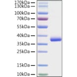 SDS-PAGE - Recombinant SARS-CoV-2 Spike RBD Protein (C-terminal His Tag) (A331826) - Antibodies.com