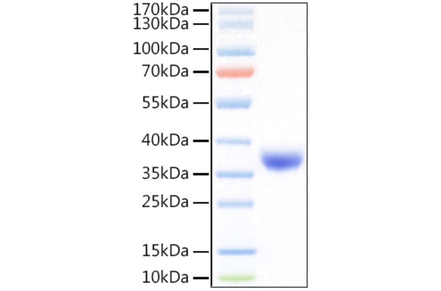 SDS-PAGE - Recombinant SARS-CoV-2 Spike RBD Protein (C-terminal His Tag) (A331827) - Antibodies.com