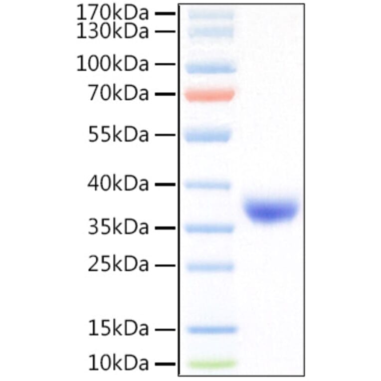 SDS-PAGE - Recombinant SARS-CoV-2 Spike RBD Protein (C-terminal His Tag) (A331827) - Antibodies.com