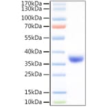 SDS-PAGE - Recombinant SARS-CoV-2 Spike RBD Protein (C-terminal His Tag) (A331827) - Antibodies.com