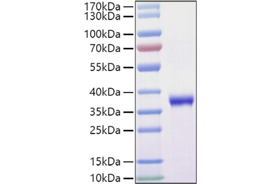 SDS-PAGE - Recombinant SARS-CoV-2 Spike RBD Protein (C-terminal His and Avi Tag) (A331828) - Antibodies.com
