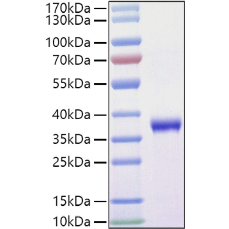 SDS-PAGE - Recombinant SARS-CoV-2 Spike RBD Protein (C-terminal His and Avi Tag) (A331828) - Antibodies.com