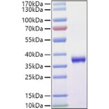 SDS-PAGE - Recombinant SARS-CoV-2 Spike RBD Protein (C-terminal His and Avi Tag) (A331828) - Antibodies.com