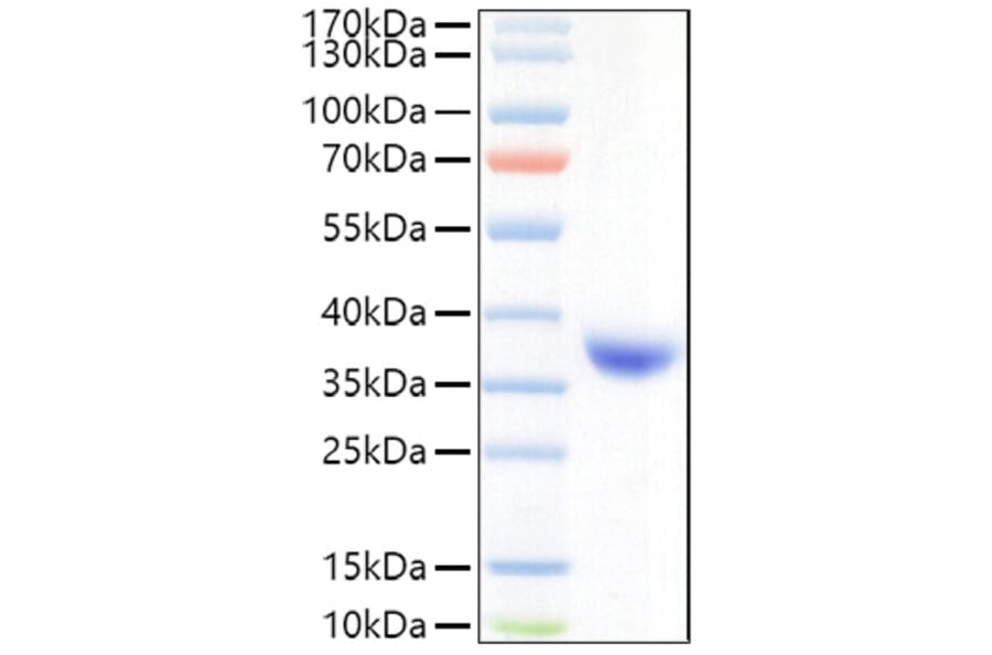 SDS-PAGE - Recombinant SARS-CoV-2 Spike RBD Protein (C-terminal His Tag) (A331829) - Antibodies.com