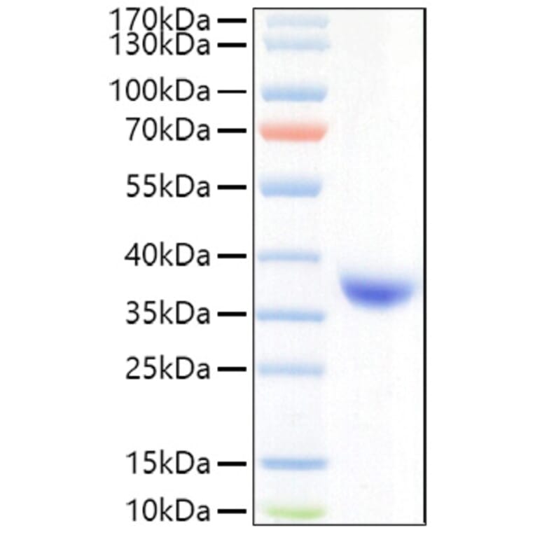 SDS-PAGE - Recombinant SARS-CoV-2 Spike RBD Protein (C-terminal His Tag) (A331829) - Antibodies.com