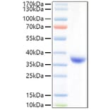SDS-PAGE - Recombinant SARS-CoV-2 Spike RBD Protein (C-terminal His Tag) (A331829) - Antibodies.com