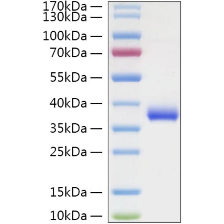 SDS-PAGE - Recombinant SARS-CoV-2 Spike RBD Protein (C-terminal His Tag) (A331830) - Antibodies.com