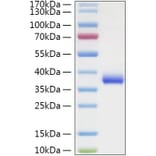 SDS-PAGE - Recombinant SARS-CoV-2 Spike RBD Protein (C-terminal His Tag) (A331830) - Antibodies.com