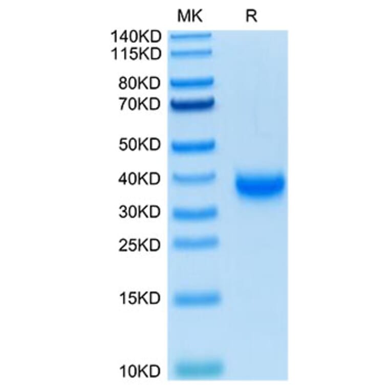 Tris-Bis PAGE - Recombinant SARS-CoV-2 Spike RBD Protein (C-terminal His and Avi Tag) (A331831) - Antibodies.com