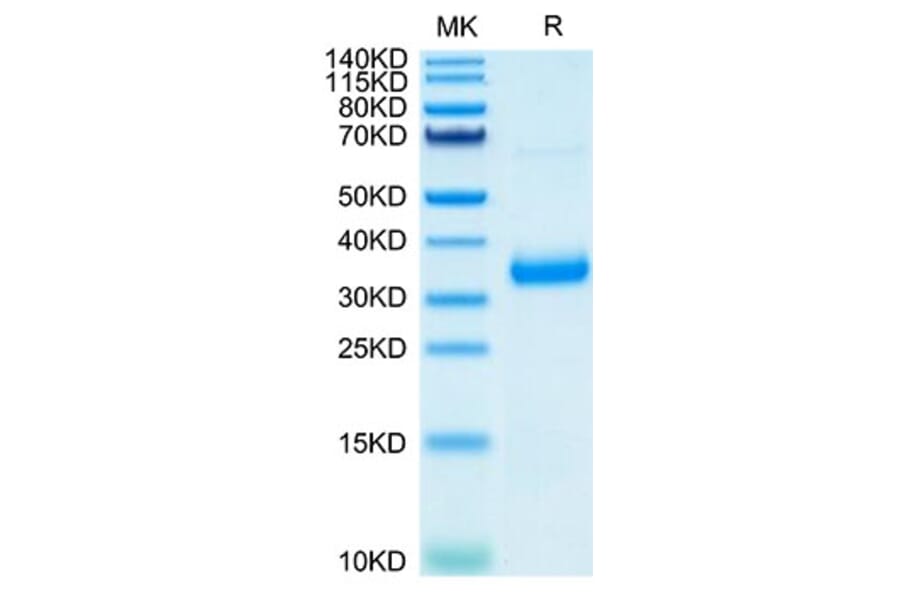 Tris-Bis PAGE - Recombinant SARS-CoV-2 Spike RBD Protein (C-terminal His Tag) (A331832) - Antibodies.com