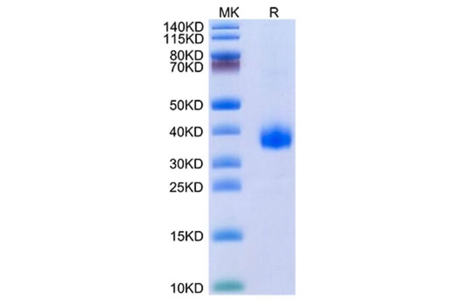 Tris-Bis PAGE - Recombinant SARS-CoV-2 Spike RBD Protein (C-terminal His Tag) (A331833) - Antibodies.com