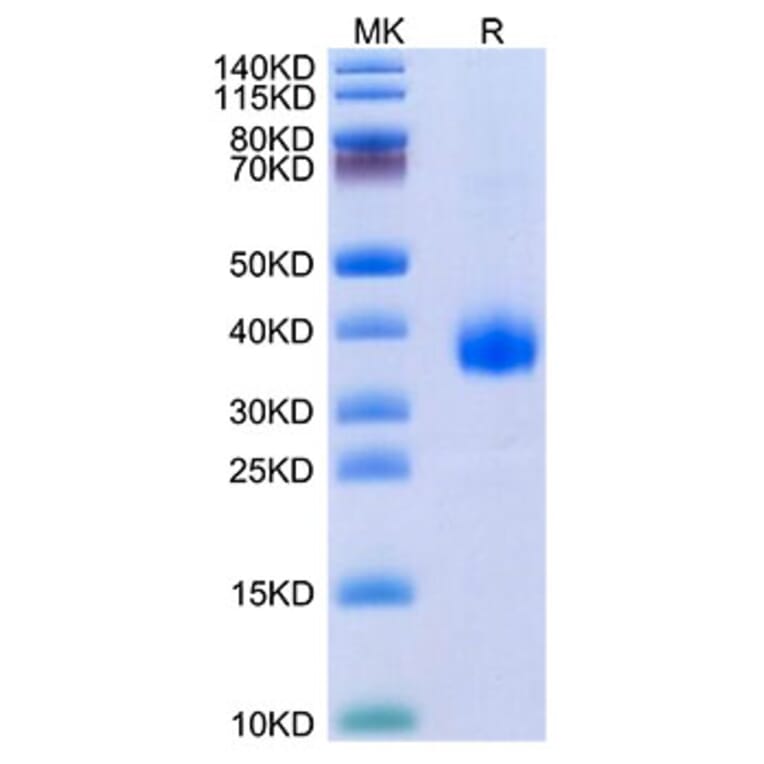 Tris-Bis PAGE - Recombinant SARS-CoV-2 Spike RBD Protein (C-terminal His Tag) (A331833) - Antibodies.com