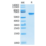 Tris-Bis PAGE - Recombinant SARS-CoV-2 Spike RBD Protein (C-terminal Human Fc and Avi Tag) (A331834) - Antibodies.com