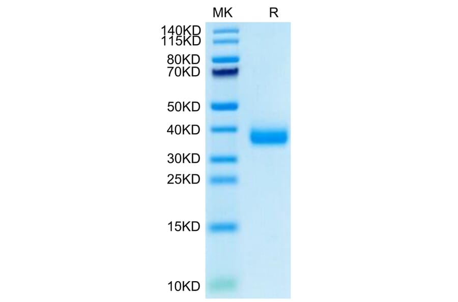 SDS-PAGE - Recombinant SARS-CoV-2 Spike RBD Protein (C-terminal His Tag) (A331836) - Antibodies.com