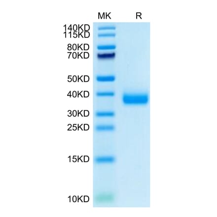 SDS-PAGE - Recombinant SARS-CoV-2 Spike RBD Protein (C-terminal His Tag) (A331836) - Antibodies.com