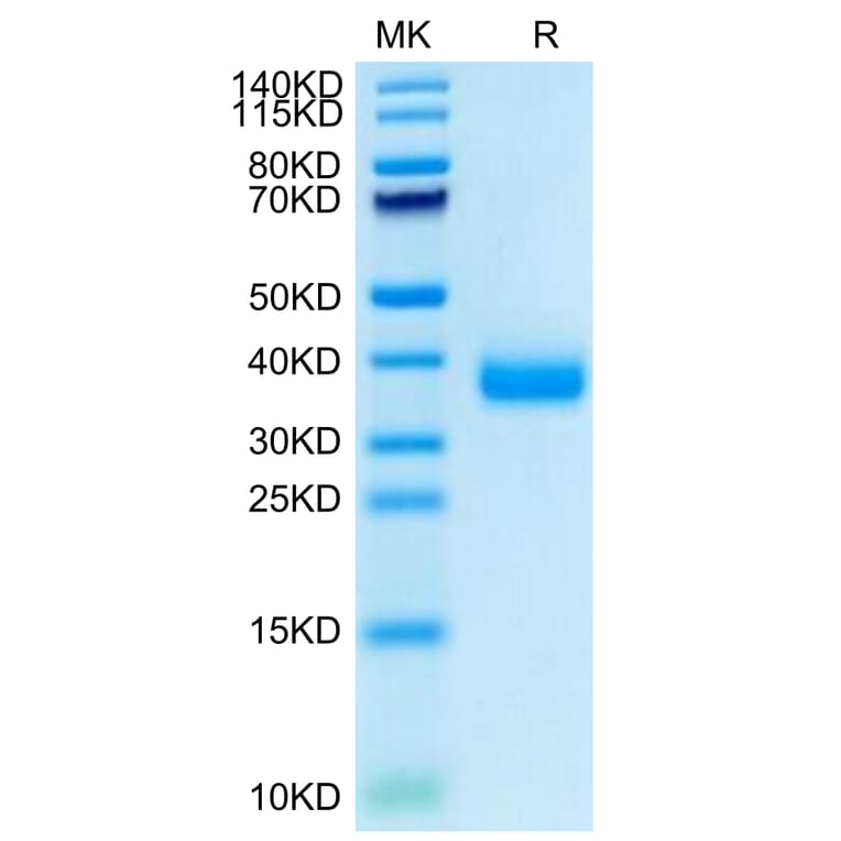 SDS-PAGE - Recombinant SARS-CoV-2 Spike RBD Protein (C-terminal His Tag) (A331836) - Antibodies.com