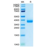 SDS-PAGE - Recombinant SARS-CoV-2 Spike RBD Protein (C-terminal His Tag) (A331836) - Antibodies.com