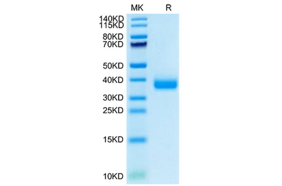 Tris-Bis PAGE - Recombinant SARS-CoV-2 Spike RBD Protein (C-terminal His Tag) (A331836) - Antibodies.com