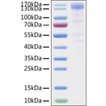 SDS-PAGE - Recombinant SARS-CoV-2 Spike RBD Protein (C-terminal Human Fc Tag) (A331837) - Antibodies.com