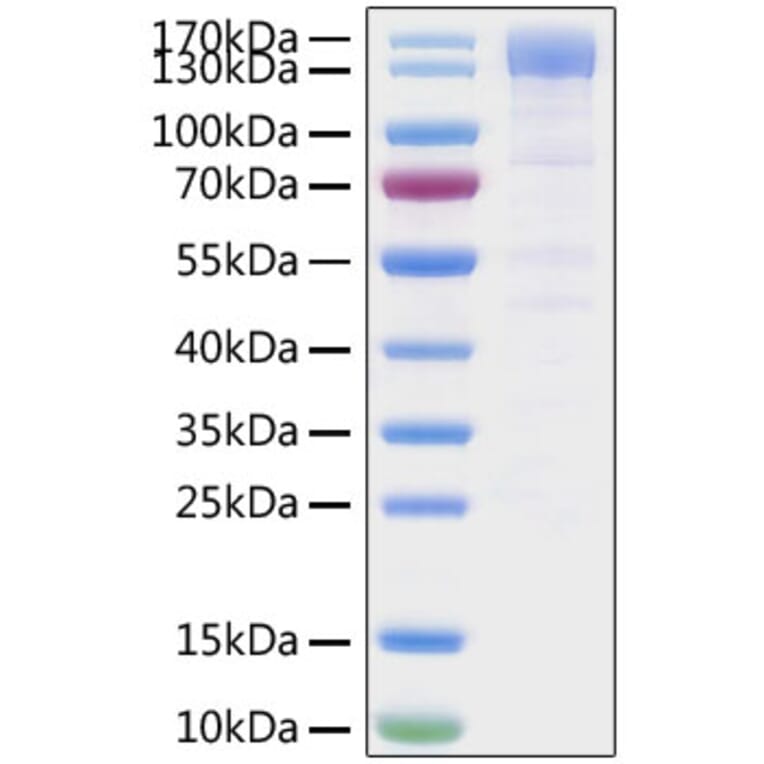 SDS-PAGE - Recombinant SARS-CoV-2 Spike RBD Protein (C-terminal Mouse Fc Tag) (A331838) - Antibodies.com