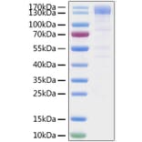 SDS-PAGE - Recombinant SARS-CoV-2 Spike RBD Protein (C-terminal Mouse Fc Tag) (A331838) - Antibodies.com