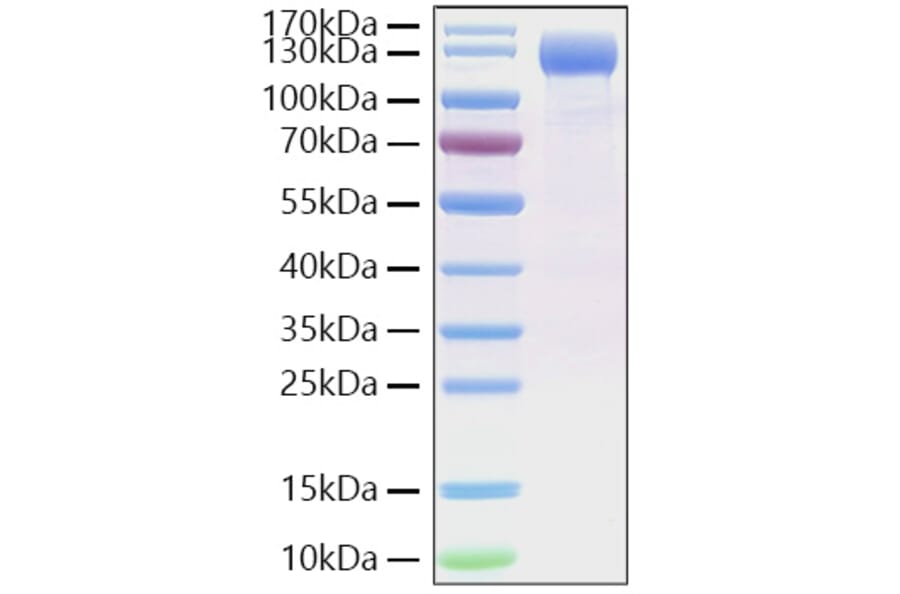 SDS-PAGE - Recombinant SARS-CoV-2 Spike RBD Protein (C-terminal His Tag) (A331839) - Antibodies.com