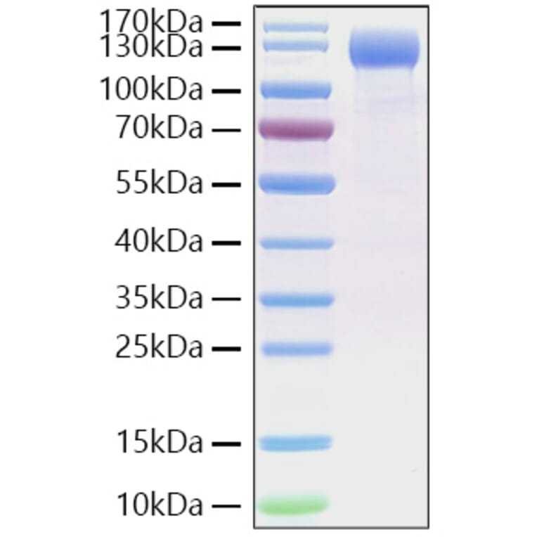 SDS-PAGE - Recombinant SARS-CoV-2 Spike RBD Protein (C-terminal His Tag) (A331839) - Antibodies.com