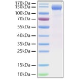 SDS-PAGE - Recombinant SARS-CoV-2 Spike RBD Protein (C-terminal His Tag) (A331839) - Antibodies.com